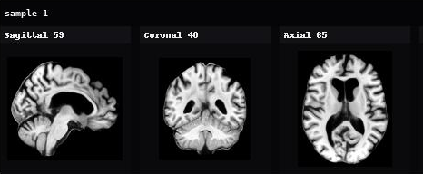 AnaDiffusion sample 1 in sagittal, coronal, and axial views