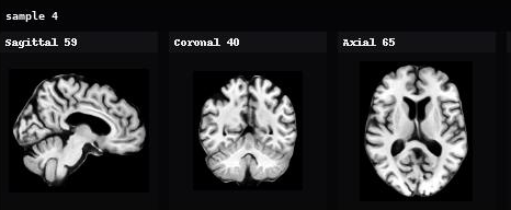 AnaDiffusion sample 4 in sagittal, coronal, and axial views