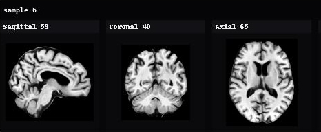 AnaDiffusion sample 6 in sagittal, coronal, and axial views