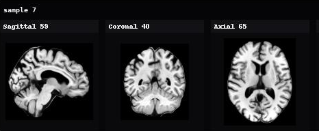 AnaDiffusion sample 7 in sagittal, coronal, and axial views