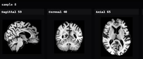 AnaDiffusion sample 8 in sagittal, coronal, and axial views