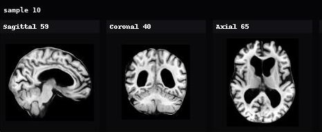 AnaDiffusion sample 10 in sagittal, coronal, and axial views